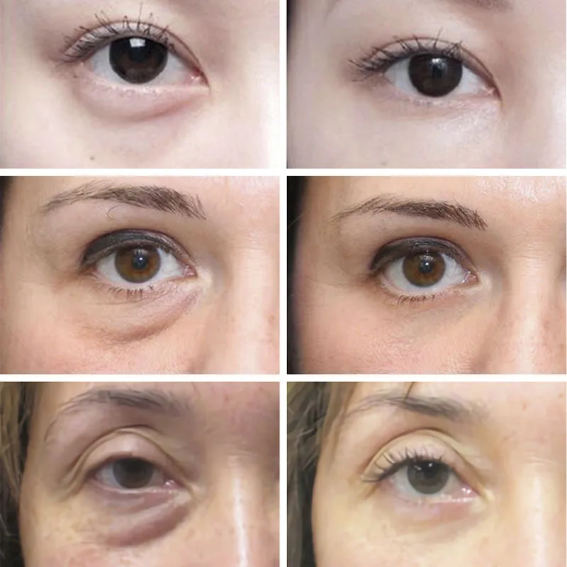 O'Contest-Crème anti-cernes po - Skincare D'Alba avis et prix